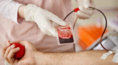 Close up of nurse adjusting blood bag of male donor at blood donation center or hospital